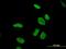 DDX11 antibody, H00001663-M03, Novus Biologicals, Immunofluorescence image 