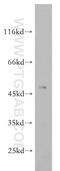 ETS Transcription Factor ELK4 antibody, 14666-1-AP, Proteintech Group, Western Blot image 