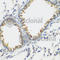 Fms Related Tyrosine Kinase 4 antibody, A5605, ABclonal Technology, Immunohistochemistry paraffin image 
