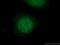 SWI/SNF-related matrix-associated actin-dependent regulator chromatin subfamily E member 1 antibody, 66182-1-Ig, Proteintech Group, Immunofluorescence image 