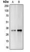Carbonic Anhydrase 14 antibody, MBS821581, MyBioSource, Western Blot image 