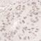 DEAD-Box Helicase 17 antibody, A300-509A, Bethyl Labs, Immunohistochemistry frozen image 