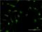 Heparin Binding Growth Factor antibody, H00003068-M09, Novus Biologicals, Immunofluorescence image 