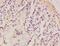 EGFR antibody, orb5128, Biorbyt, Immunohistochemistry paraffin image 