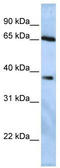 Ubiquitin carboxyl-terminal hydrolase 3 antibody, TA334221, Origene, Western Blot image 