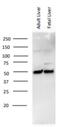GC Vitamin D Binding Protein antibody, NBP1-88027, Novus Biologicals, Western Blot image 