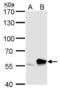 RTKN antibody, NBP2-20239, Novus Biologicals, Western Blot image 