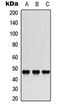 Jun Proto-Oncogene, AP-1 Transcription Factor Subunit antibody, LS-C368400, Lifespan Biosciences, Western Blot image 