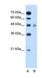 Solute Carrier Family 17 Member 4 antibody, orb325103, Biorbyt, Western Blot image 