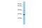 Cysteine Rich Secretory Protein 3 antibody, PA5-45558, Invitrogen Antibodies, Western Blot image 