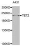 Methylcytosine dioxygenase TET2 antibody, PA5-76801, Invitrogen Antibodies, Western Blot image 