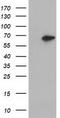 Epoxide Hydrolase 2 antibody, CF501761, Origene, Western Blot image 