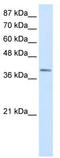 LIM Homeobox Transcription Factor 1 Alpha antibody, TA329740, Origene, Western Blot image 