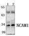 Fibroblast Growth Factor 5 antibody, A03776, Boster Biological Technology, Western Blot image 
