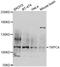 Transient Receptor Potential Cation Channel Subfamily C Member 4 antibody, A6996, ABclonal Technology, Western Blot image 