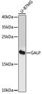 Galanin-like peptide antibody, 16-945, ProSci, Western Blot image 