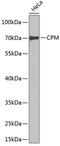 Carboxypeptidase M antibody, 22-316, ProSci, Western Blot image 