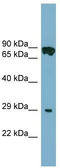 Cytochrome B5 Domain Containing 1 antibody, TA340339, Origene, Western Blot image 