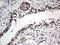 Homeobox D9 antibody, M06166, Boster Biological Technology, Immunohistochemistry paraffin image 