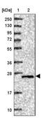 Phosphatidylinositol-4,5-Bisphosphate 4-Phosphatase 1 antibody, NBP2-13453, Novus Biologicals, Western Blot image 