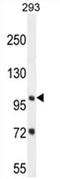 Zinc Finger And BTB Domain Containing 10 antibody, AP54610PU-N, Origene, Western Blot image 