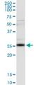 Clathrin light chain antibody, H00001211-M08, Novus Biologicals, Western Blot image 