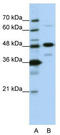 Nucleolar Protein 4 antibody, TA345857, Origene, Western Blot image 