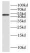 Heterogeneous nuclear ribonucleoprotein H antibody, FNab03953, FineTest, Western Blot image 