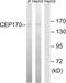 Centrosomal Protein 170 antibody, LS-C198793, Lifespan Biosciences, Western Blot image 