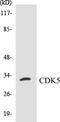 Cyclin Dependent Kinase 5 antibody, EKC1109, Boster Biological Technology, Western Blot image 