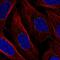 Protein dpy-19 homolog 1 antibody, HPA059139, Atlas Antibodies, Immunofluorescence image 