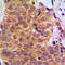 HAP antibody, LS-C352766, Lifespan Biosciences, Immunohistochemistry paraffin image 
