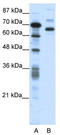 CCCTC-Binding Factor Like antibody, TA341444, Origene, Western Blot image 
