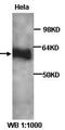 Aquaporin-10 antibody, orb77110, Biorbyt, Western Blot image 