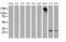Pyrroline-5-Carboxylate Reductase 3 antibody, MA5-25335, Invitrogen Antibodies, Western Blot image 