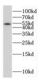 Probable serine carboxypeptidase CPVL antibody, FNab01947, FineTest, Western Blot image 