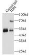 Tyrosyl-DNA Phosphodiesterase 1 antibody, FNab08572, FineTest, Immunoprecipitation image 