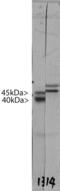 Doublecortin antibody, MBS415010, MyBioSource, Western Blot image 