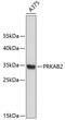 Protein Kinase AMP-Activated Non-Catalytic Subunit Beta 2 antibody, 19-254, ProSci, Western Blot image 