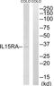 Interleukin 15 Receptor Subunit Alpha antibody, TA314083, Origene, Western Blot image 