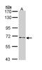 NUMB Endocytic Adaptor Protein antibody, LS-B4857, Lifespan Biosciences, Western Blot image 