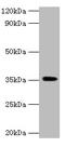 Docking Protein 5 antibody, A54752-100, Epigentek, Western Blot image 