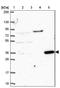 Ceroid-lipofuscinosis neuronal protein 6 antibody, NBP2-39066, Novus Biologicals, Western Blot image 