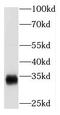 N-Acetyltransferase 1 antibody, FNab05561, FineTest, Western Blot image 