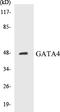 GATA Binding Protein 4 antibody, EKC1237, Boster Biological Technology, Western Blot image 