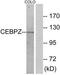 CCAAT/enhancer-binding protein zeta antibody, TA315022, Origene, Western Blot image 