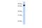Leucine Rich Repeats And Calponin Homology Domain Containing 4 antibody, A13633, Boster Biological Technology, Western Blot image 
