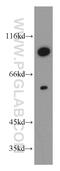 GST antibody, 11078-1-AP, Proteintech Group, Western Blot image 