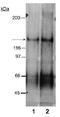 NPC1 Like Intracellular Cholesterol Transporter 1 antibody, GTX30675, GeneTex, Western Blot image 