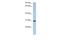 PDZ Domain Containing 9 antibody, PA5-70140, Invitrogen Antibodies, Western Blot image 